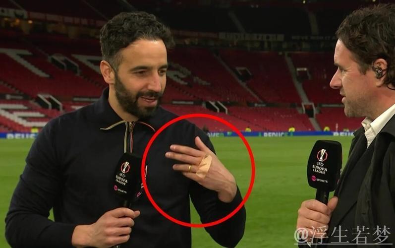 阿莫林拳头现新伤痕疑再怒!不满曼联阵容认同名宿批评 阿莫林拳头现新伤痕疑再怒!不满曼联阵容认同名宿批评